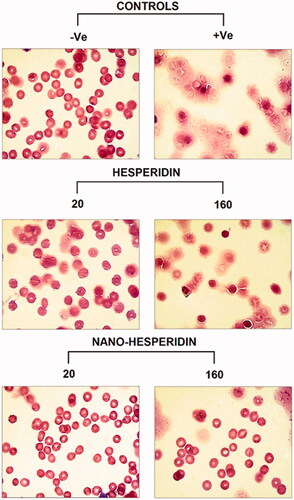 Figure 13. Light microscope photographs of RBCs treated with two concentrations (20 and 160 (µg mL−1) of pure hesperidin and (B) modified nanohesperidin loaded in PLGA- Polixamar 407.