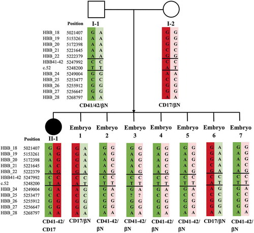 Figure 2. Results of SNP-based pedigree analysis and PGT for β-thalassemia (Family 1). I-1: male patient. I-2: female patient. II-1: proband. SNP: single-nucleotide polymorphism. PGT: preimplantation genetic testing. ‘?’ indicates that no detection result was obtained for this SNP site. Double horizontal lines represent pathogenic site boundaries. In pedigree analysis, as the genotype of II-1 was CD41-42/CD17, pathogenic haplotypes were the two carried by II-1 (marked with dark red and dark green backgrounds). Based on SNP-based PGT, all seven embryos were identified as unaffected carriers or noncarriers because they carried only one, or no, pathogenic haplotype