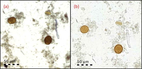 Figure 3. Stool sample showing A. lumbricoides eggs, digitized with (a) mobile microscope, and (b) reference slide-scanner.