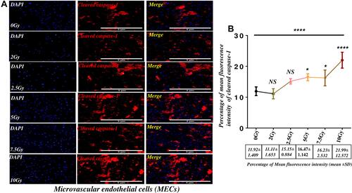 Figure 6 Gamma radiation directly activates Caspase-1 dependent pathway in microvascular endothelial cells.