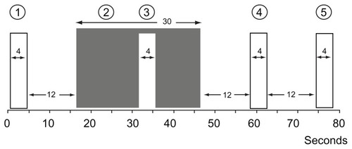 Figure 3 The conditioned pain modulation efficiency with repeated phasic heat stimuli (47°C, 4 seconds [1, 3–5]) in relation to submersion of the nondominant hand (2) in the cold pressor test (0.3°C–0.5°C, 30 seconds).