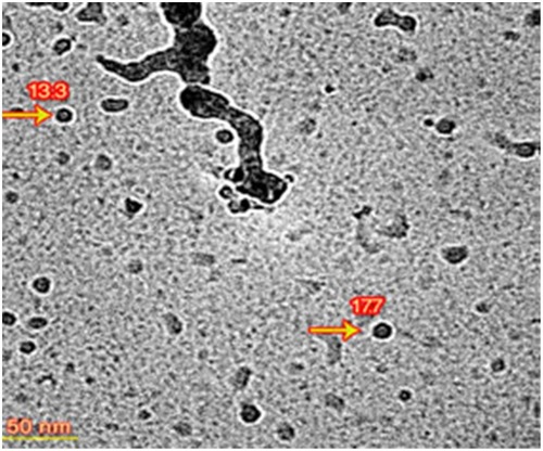 Figure 4 Cryo TEM image of PVCL-Lys nano-hydrogel.Abbreviations: TEM, transmission electro microscopy; PVCL, poly(N-vinylcaprolactam).