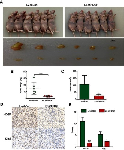 Figure 5 HDGF deletion suppresses T24 cell tumorigenicity in vivo. (A) Representative picture of animals and xenograft tumors. (B) Weights of xenograft tumors derived from T24 cells with HDGF deletion and control. (C) Tumors sizes were measured after tumors were dissected. (D) IHC examination of HDGF and Ki-67 in tumor sections (magnifications×400). (E) Histogram shows IHC scores in control and Hepatoma-derived growth factor (HDGF) deletion group. (*p<0.05; ***p<0.001).