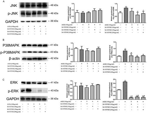Figure 8. The effect of M-SYFSF on the MAPK signaling pathway in HK-2 cells. (A) Western blot analysis of JNK and p-JNK expression (n = 3); (B) Western blot analysis of P38MAPK and p-P38MAPK expression (n = 3); (C) Western blot analysis of ERK and p-ERK expression (n = 3). *p < 0.05, **p < 0.01 compared to the control group; #p < 0.05, ##p < 0.01 compared to the model group.