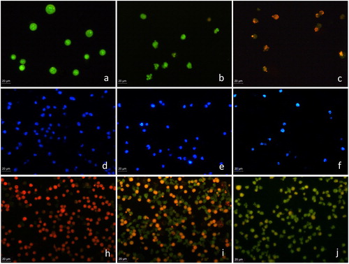 Figure 3. Fluorescent microscopy images of the morphological alterations induced by myosmine in murine erythroid leukaemia cell line MEL, clone F4N.Control cell cultures (a, d, h); cell cultures exposed to 2.5 mmol L−1 (b, e, i) or 10 mmol L−1 (c, f, j) myosmine for 24 h. Acridine orange/ethidium bromide staining (a, b); DAPI staining (c, d); Annexin V-FITC and propidium iodide staining (e, f).