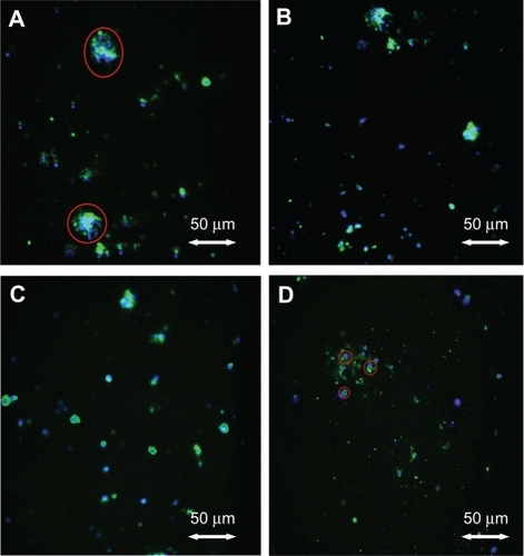 Figure 2 Fluorescent microscopy images. (A) Adherent macrophages on unanodized Ti; round blue-green shape encircled by a red line shows a well spread macrophage. (B) Nanotextured, non-nanotubular Ti. (C) Nanotubular Ti with 40–50 nm diameters, after 24 hours of culture. (D) Nanotubular Ti with 60–70 nm diameters, after 24 hours of culture, showing macrophages (encircled in red lines) with little spreading.Abbreviation: Ti, titanium.