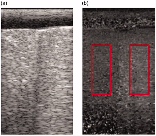 Figure 5. Conventional B-mode image (a) and nonlinearity image (b) of pig tissue.