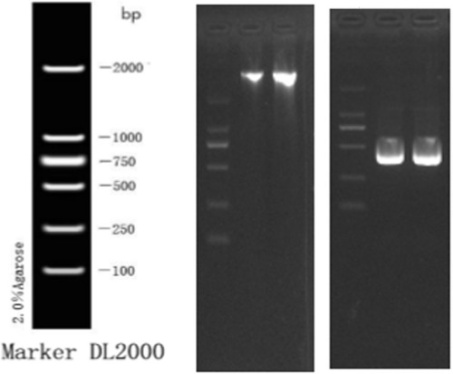 Figure 2 The DNA electrophoresis results (left) and the electrophoresis result of PCR amplification products (right).