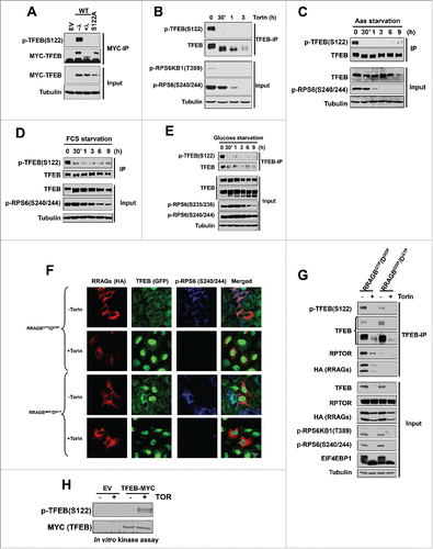 Figure 2. TFEB serine 122 is regulated by MTORC1. (A) Validation of the p-TFEB (S122) antibody. HeLa cells were transfected with the indicated MYC-tagged TFEB constructs followed by MYC-IP and western blot. λ, lambda-phosphatase treatment of immunoprecipitates. HeLa cells were treated with Torin1 (250 nM) (B), or starved for amino acids (C), serum (D), or glucose (E). (F, G) HeLa cells were transfected with active (RRAGBGTP/DGDP) or inactive (RRAGBGDP/DGTP) RRAG-GTPases and its effects on TFEB localization and phosphorylation were assessed. (H) MTOR in vitro kinase assay of epitope tag immunoprecipitates from cells transfected with empty vector (EV) vs. MYC-TFEB and incubated with or without recombinant MTOR. Scale bar: 10 μm.