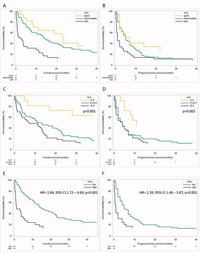 Figure 4. Different scores and their influence on outcome parameters in cancer patients. The GPS has prognostic value regarding OS (A) and PFS (B) in our cohort of patients undergoing ICI therapy. Neutrophil to lymphcyte Ratio is strongly prognostic regarding OS (C) and PFS (D) in our cohort of patients. GRIm Score has prognostic value regarding OS (E) and PFS (F) in our cohort of patients treated with ICIs.