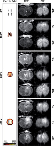 Figure 5. T2-weighted (T2W) and DW-MRI (b = 800) of the rat brain: Representative coronal MRI scans at selected time points and all voltage levels. In the DW-MRI images the hyper-intensity reflects low diffusivity and hypo-intense regions reflect high diffusivity. The left column shows the calculated electric field distributions in the range 350–1200 V/cm. White arrows in the top panel (T2W) indicate the tracks left by the electrodes (black arrows).