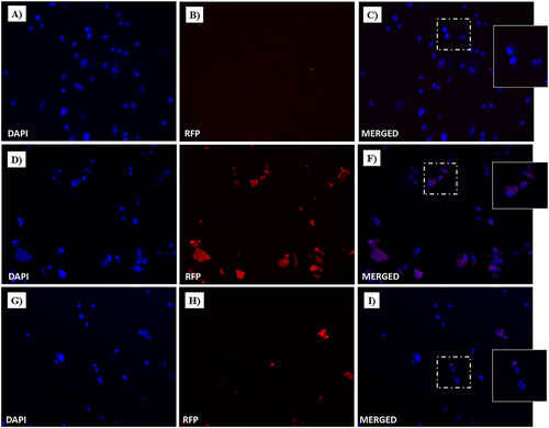 Figure 18 Fluorescent microphotographs of monolayers showing the cellular location of doxorubicin (Dox) into human MDA-MB-231 TNBC cells after cellular up-take inhibition sodium azide and then to free-Dox (A–C), NF-Dox (D–F) and P1+P2+P3+Dox (G–I) application. MDA-MB-231 were incubated with free-Dox (7.5 μM), NF-Dox and P1+P2+P3+Dox (50 µM, ie, 7.5 µM of Dox) for 1 h. Nuclei are shown in blue, stained with DAPI. The intrinsically fluorescence of Dox (RFP channel) is shown in red. Merged images derived from the overlapping of the two fluorescent emissions. The images shown are representative of 3 independent experiments.
