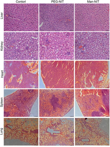Figure 8. HE staining of liver, kidney, heart, spleen and lung tissue in nude mice (400×).