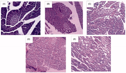 Figure 3. Histoarchitecture studies of rat pancreas of islets of Langerhans at magnification of 100×. (A) Normal control, (B) diabetic control, (C) HEF (1000 mg/kg, p.o.), (D) glimepiride (4 mg/kg, p.o.), and (E) combination (HEF extract 500 mg/kg, p.o. and glimepiride 2 mg/kg, p.o.).