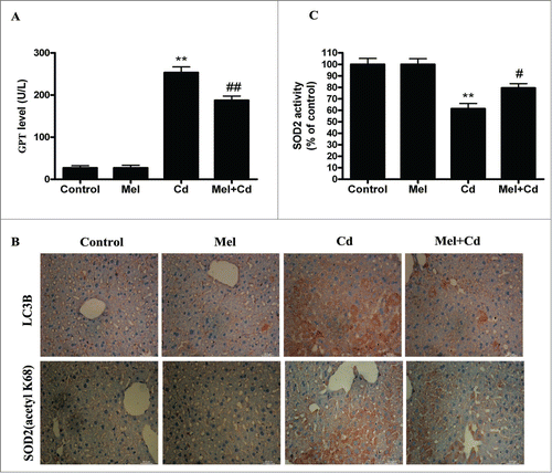 Figure 10. Melatonin suppresses Cd-induced autophagic cell death by enhancing SIRT3 activity in vivo. (A) Serum GPT activity was measured. (B) Immunohistochemical analysis of LC3B and SOD2 (acetyl K68) expression in liver tissue. (C) SOD2 activity in liver tissue. The results are expressed as a percentage of the control group, which is set at 100 %. The values are presented as the means ± SEM, **p < 0.01 versus the Cd group, and #p < 0.05, ##p < 0.01 vs. the Mel + Cd group. (n = 8.)