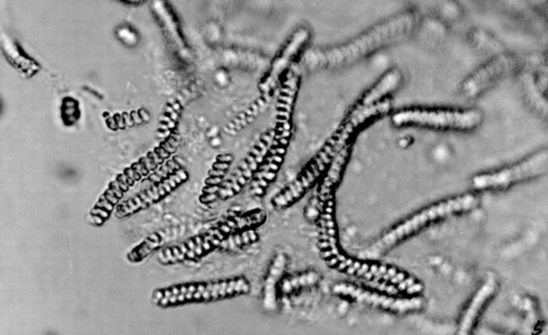 Figure 2. Microscopic photo of Spirulina subsalsa in immobilized culture.