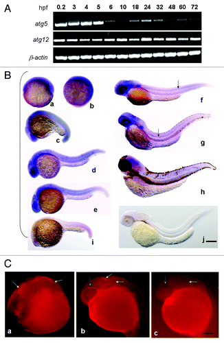 Figure 2. Spatiotemporal expression of autophagy related gene atg5 during zebrafish embryonic development. (A) Expression stage-pattern of atg5 during zebrafish embryonic development. Atg5 and atg12 mRNAs were detected as early as 0.2 hpf and throughout the whole development up to 72 hpf with RT-PCR in different developmental stages (hpf). β-actin was used as a loading control. (B) Atg5 transcription mainly in brain region and the central neural system. Antisense atg5 RNA probe was used for whole-mount in situ hybridization on zebrafish embryos at 6 hpf (a), 10 hpf (b), 18 hpf (c), 24 hpf (d), 30 (e), 48 hpf (f), 72 hpf (g), 96 hpf (h); and sense atg5 RNA probe was used for embryos at 22 hpf (i) and 48 hpf (j) as negative controls.Scale bar: 400 μm. (C) Protein of ATG5 presented in brain region in zebrafish embryo. Whole-mount immunofluorescent histochemistry was performed to reveal ATG5 protein localization on 24 hpf wild-type embryo with anti-ATG5 polyclonal antibody (Abcam, 1:500 dilution) (a,b), without anti-ATG5 polyclonal antibody as a control (c). Yellow arrows indicate ATG5 positive area in brain in (a and b), negative in (c). Green arrows show ATG5 positive signal in eye circumferential in (b), and negative in (c). Scale bar: 250 µm