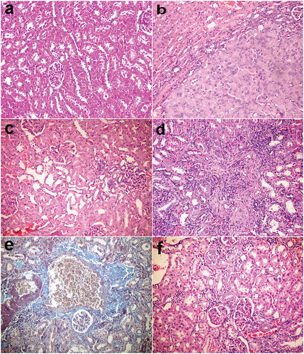 Figure 3. Kidneys, rats (38th week). (a) Normal renal tissue in group I control group. (b) Tubular cell adenoma of solid pattern with compression of adjacent parenchyma in group V injected with DENA. (c) Minor histopathological alteration in group VI injected with DENA and treated with camel milk. (d) Mononuclear inflammatory cells infiltration in the interstitial tissue with thickening of glomerular and tubular basement membrane and fibroplasia in group VII injected with DENA and treated with cisplatin. (e) Bluish-stained periglomerular and interstitial fibroplasia (Massons’ trichrome stain). (f) Few mononuclear inflammatory cells infiltration with regenerated renal tubules in group VI injected with DENA and treated with camel milk and cisplatin. Haematoxylin and eosin stain 200×.