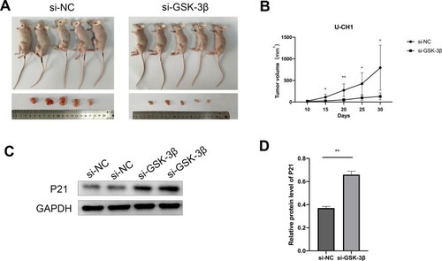 Figure 7 Silencing GSK-3β inhibited the proliferation of chordoma cells in vivo. (A) Tumor images of nude mice in the si-GSK-3β and control groups (n = 5 mice/group). (B) Tumor volumes of nude mice in the si-GSK-3β and control groups, measured every 5 days. (C) Expression of P21 protein in xenograft tumors transfected with si-GSK-3β. (D) Grayscale analysis of Western blot results using ImageJ. *p < 0.05; **p < 0.01.