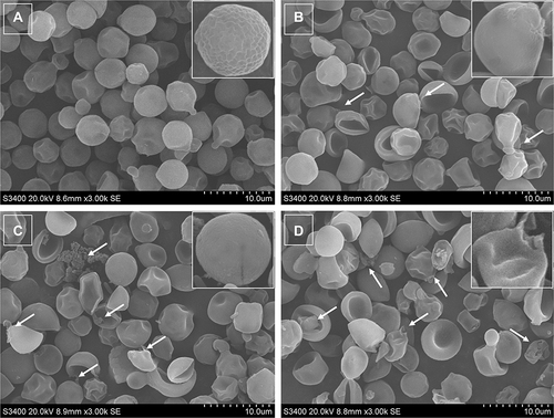 Figure 5 SEM images of AMP-17-treated C. neoformans planktonic cells. Untreated C. neoformans cells presented a round or oval appearance, and the cell surface was smooth with clear cell boundaries (A). The cells treated with AMP-17 (1, 2, and 4× MIC) at 6 h showed severe damage, such as the cell size differed greatly, the surface was sunken, irregularities in shape, and the cells ruptured and shrunk (B, C and D). One representative results out of two independent experiments is shown. Images were captured using a 3000 × power field. Scale bar, 10 μm.