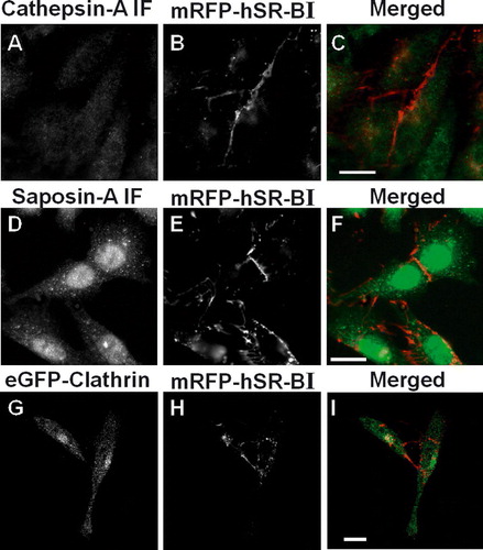 Figure 7.  mRFP-tagged hSR-BI does not co-localize with lysosomal markers or with clathrin. LdlA[mRFP-hSR-BI] cells (panels A–F) and ldlA7 cells stably expressing both eGFP-clathrin and mRF-hSR-BI (panels G–I) were cultured on glass cover slips and fixed. Cells were permeabilized and immunostained for lysosomal markers cathepsin A (panel A) or saposin A (panel D). Alexa 488 labeled secondary antibody was used for detection prior to wide-field epifluorescence microscopy using a Zeiss Axiovert 200 M inverted microscope. Alternatively, cells were imaged directly (panels G–I) using a Zeiss LSM510 laser scanning confocal microscope. A, D and G: Alexa 488 or eGFP fluorescence. B, E and H: mRFP fluorescence. C, F and I: merged color images in which green corresponds to cathepsin A (panel C), saposin A (panel F) or eGFP-clathrin (panel I) and red corresponds to mRFP-hSR-BI. Scale bars = 10 µm. Representative images are shown.