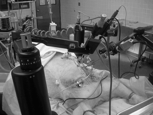 Figure 2. Setup of Zeus-assisted surgery. (Contributed by C. Knight.) (Color version available online.)