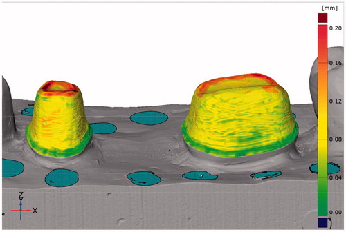 Figure 1. Image from the CAD software used for fit measurements with the triple-scan protocol. Measuring points are obtained from the full surface of the tooth-restoration intaglio.