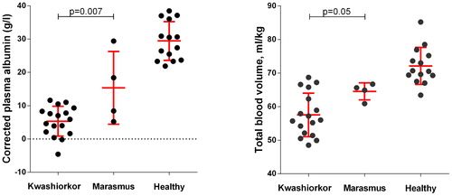 Figure 4. Corrected albumin concentrations and total blood volume measurements in children with kwashiorkor, marasmus, and healthy controls, from Viart.Citation43 The malnourished children selected for this comparison were aged <3 years, with kwashiorkor defined as having ≧2+ oedema, and marasmus as having 0 or ± oedema. The error bars show the mean and standard deviation values.