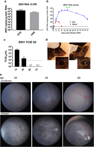 Fig. 2 ZIKV infects the eye and causes chorioretinal lesions.a Levels of viral RNA in CNS and eye at 15 dpi (mean ± SD, n = 6; p = ns); b Levels of viral RNA in whole blood and eye homogenates over time. ZIKV RNA was measured in the blood, brain, and eye of B6wt mice (mean ± SD, n ≥ 3 mice/time point) using quantitative real-time PCR. Values are presented as number of viral RNA copies/microgram of total RNA. Green line represents the period when mice display ataxia and seizuresCitation29. c Levels of infectious ZIKV was measured by TCID50 assay using eye homogenates from ZIKV-infected mice (mean ± SD, n ≥ 3 mice/time point) at 30, 60, and 75 dpi. Dotted line represents lower limit of quantification of the assay. d Opacity of the cornea in ZIKV-infected (30 dpi, right) and age-matched control (left); overall incidence was 12%. Inset shows magnification of the eye; e Fundus image of uninfected age-matched controls (top panels) and ZIKV-infected (bottom panels) B6wt mice showing hypoautofluorescent lesions at 30, 45, and 60 dpi (representative of six mice/time point)