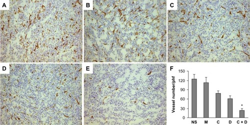 Figure 8 Normal saline group (A), MPEG-PCL group (B), Cur/MPEG-PCL group (C), Dox/MPEG-PCL group (D), Cur-Dox/MPEG-PCL group (E), and vessel density of tumor tissues in each group (F). *P<0.05. Bars indicate standard deviation; columns show the mean.Abbreviations: Cur, curcumin; Dox, doxorubicin; MPEG, methoxy poly(ethylene glycol); PCL, poly(caprolactone); phf, per high field; NS, normal saline; M, MPEG-PCL; C, Cur/MPEG-PCL; D, Dox/MPEG-PCL; C+D: Cur-Dox/MPEG-PCL.