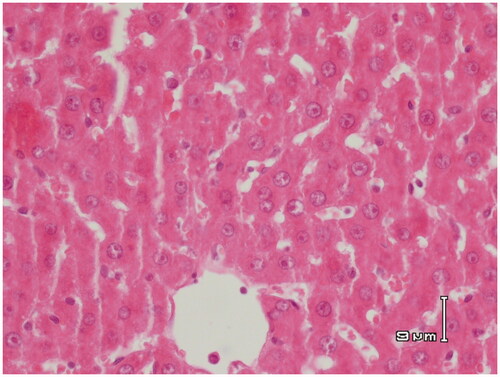 Figure 8. Paraffin sections stained by haematoxylin and eosin (H&E) for histopathological examination of liver tissues of rats treated with APAP (500 mg/kg) and RA (100 mg/kg). RA 100 mg/kg restored the normal architecture of the hepatic lobules and the hepatocytes.