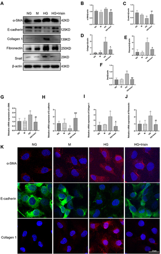 Figure 3 Irisin’s role in reducing HG-induced EMT and the production of proteins associated with fibrosis in Hk-2 cells. (A–F) The quantitative findings related to the Western blot detection of α-SMA, E-cadherin, Collagen 1, Fibronectin and Snail expressions in HK-2 cells. (G–J) RT-qPCR was used to ascertain the mRNA levels of α-SMA, E-cadherin, Collagen 1, and Fibronectin. (K) Representative images of α-SMA, E-cadherin and Collagen 1 were obtained by immunofluorescence staining in HK-2 cell. At least three independent runs of each experiment were completed. Values are expressed as mean ± SD. *p < 0.05 vs NG group, **p < 0.01 vs NG group, ***p < 0.001 vs NG group, #p < 0.05 vs HG group, ##p < 0.01 vs HG group, ###p < 0.001 vs HG group.