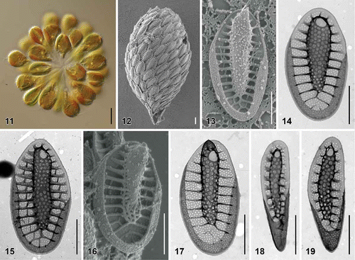 Figs. 11–19. Scale morphology of Synura heteropora sp. nov. (Fig. 11: LM; Figs 12, 13, 16: SEM; Figs 14, 15, 17–19: TEM). Scale bars represent 10 μm (Fig. 11) and 1 μm (Figs 12–19). Fig. 11. Colony consisting of densely grouped, pyriform cells (strain S 20.45). Fig. 12. Single cell surrounded by a layer of siliceous scales (S 54.E11). Fig. 13. Body scale (S 54.E11). Fig. 14. Body scale (S 20.45). Fig. 15. Body scale with transverse folds interconnecting the struts (S 87.C6). Fig. 16. Apical scale (S 54.E11). Fig. 17. Apical scale with a pronounced, rounded keel tip (S 101.F7). Figs 18, 19. Rear scales (S 101.F7).