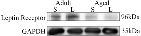 Figure 6 Western blotting analysis of leptin receptor expression in the adult + leptin group, adult + saline group, aged + leptin group and aged + saline group.