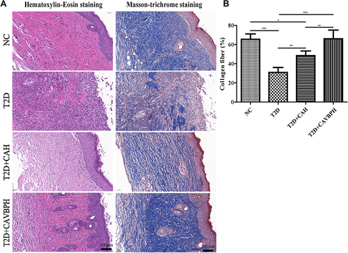 Figure 5 Histopathological staining of skin wounds in the normal control (NC) group, T2D group, CAH (T2D+CAH) group, and CAVBPH (T2D+CAVBPH) group on day 14. (A) Representative H&E and Masson staining images (scale bar = 100 μm). (B) Quantitative analysis of collagen fiber. *p < 0.05, **p < 0.01, and ***p < 0.001.