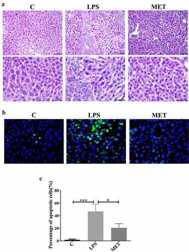 Figure 2. Effects of metformin on liver injury and inflammation in septic, aged mice. (a) H&E staining indicated the presence of inflammatory infiltrates, edema, and hemorrhage in the LPS group; however, metformin treatment ameliorated these abnormalities (scale bars = 100 μm/50 μm). (b) The TUNEL assay results in the three groups (scale bars = 50 μm). (c) The percentage of apoptotic cells in the three groups. (n = 3 per group).