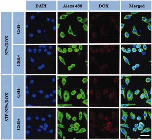 Figure 7. Typical CLSM images of NPs/DOX and STP-NPs/DOX intracellular uptake, with or without 10.0 mM GSH for two hours. From left to right, the images represent DAPI-stained cellular nuclei (blue), Alexa 488-stained F-actin (green), intracellular DOX fluorescence (red), and the overlays of above three images. Scale bar = 20 μm.