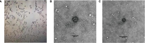 Figure 4. Cytopathic effect (CPE) as analysed through electron microscopy after inoculating stool suspension into Vero cells. (A) Complete CPE was observed using optical microscopy after inoculating stool suspension of strain HLJ002 into Vero cells and a virus particle with typical morphology of coronavirus was observed using transmission electron microscopy at (B) high magnification and (C) low magnification, respectively.
