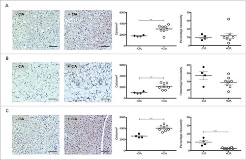 Figure 4. Characterization of renal WAT, gonadal WAT and inter-scapular BAT in DBA/1 naïve and CIA mice. Representative images, total cell number and vacuolarity was analyzed in non-vasculature associated sites in –CIA and +CIA mice: (A-C) Renal WAT (D-F) Gonadal WAT (G-I) Inter-scapular BAT. –CIA (n = 4), +CIA (n = 8). Data expressed as mean ± SEM. *** = p < 0.001, ** = p < 0.01.