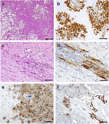 Figure 1. Representative histopathological findings of the pancreas (a) and heart (c), and immunohistochemical demonstration of type A influenza virus antigens in the pancreas (b), heart (d), brain (e), and bronchi and lung (f) of #R02, which died at 10 d.p.i. Bars indicate 100 µm (a, b, e, f) and 50 µm (c, d).