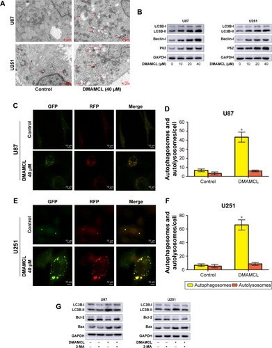 Figure 4 DMAMCL induces autophagy activity but inhibits autophagy flux in glioma cells.Notes: (A) The representative ultrastructure of autophagic vesicles (red arrows) was observed after U87-MG and U251 cells were treated with DMAMCL (40 μM) for 48 hours with transmission electron micrographs. Scale bars =4 μm. (B) Effects of DMAMCL on LC3B-II, Beclin-1, and P62 levels in U87-MG and U251 cells. (C–F) mRFP-GFP-LC3 adenovirus infection showed that being culturing with DMAMCL (40 μM) for 48 hours enhanced autophagosome accumulation and inhibited the fusion of autophagosomes with lysosomes. The green puncta represented autophagosomes, and the red puncta represented autolysosomes. Scale bars =10 μm. (G) Effects of 3-MA on DMAMCL-mediated expression levels of LC3B-II, Bcl-2 and BAX. All experiments were conducted in triplicate, and the results are displayed as the mean±SD. *P<0.05 versus the control group.Abbreviations: 3-MA, 3-methyladenine; DMAMCL, dimethylaminomicheliolide.