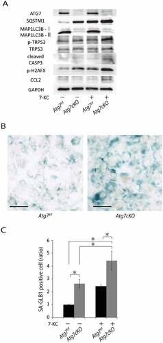 Figure 9. Autophagy-deficient SMCs are susceptible to 7-KC-induced apoptotic cell death and CCL2 expression. SMCs from control Atg7f/f and Atg7cKO mice at 10 weeks of age were isolated and exposed to 7-KC 20μM for 16 h. (A) Western blot analysis of primary isolated SMCs for ATG7, SQSTM1, MAP1LC3B-I, MAP1LC3B-II, TRP53, cleaved CASP3, phospho-H2AFX and CCL2. Representative results from 3 independent experiments are shown. (B) Senescence-associated GLB1 staining of SMCs. Scale bars: 300 μm. (C) Relative number of SMCs stained with senescence-associated GLB1. Data are shown as the mean ± SEM of 4 independent experiments. *P < 0.05 vs control Atg7f/f mice. Data from control SMCs that were not exposed to 7-KC was set to 1.0.