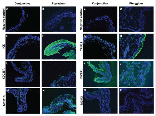 Figure 5. Fluorescent immunostaining images of conjunctiva (first and third column) and pterygium (second and fourth column) tissues using primary antibodies against ICK (E and F), TRIP13 (G and H), CDC25A (I and J), DICER1 (K and L), MCM10 (M and N), MCM3 (O and P), followed by Alexa Fluor-488 conjugated secondary antibodies. Conjunctiva and pterygium tissues which were stained with only secondary antibodies (A–D) were used as negative controls for each primary antibody used. Dicer1: dicer 1, ribonuclease type III, Mcm3: minichromosome maintenance complex component 3, Cdc25A: cell division cycle 25A, Mcm10: minichromosome maintenance complex component 10, Trip13: thyroid hormone receptor interactor 13, Ick: intestinal cell (MAK-like) kinase.