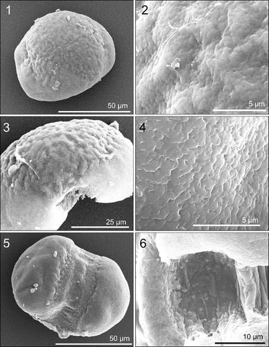 Plate 3. Scanning electron microscopy (SEM) images of Cedrus atlantica pollen grains. Scale indicated on each image. Figure 1. Polar view from the top. Figure 2. Close-up of corpus surface. Figure 3. Equatorial view. Figure 4. Close-up of saccus surface. Figure 5. Polar view from underneath the grain showing the leptoma. Figure 6. Close-up of leptoma, pollen wall visible to the left.