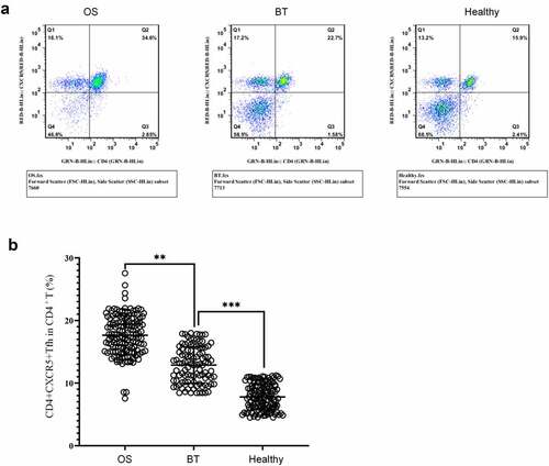 Figure 2. Expression of CD4+CXCR5+ Tfh cells in peripheral blood mononuclear cells (a) Flow cytometry-based measurement of expression of CD4+CXCR5+ Tfh cells in peripheral blood mononuclear cell (PBMCs); (b)Proportion of CD4+CXCR5+ Tfh cells in CD4+ T cells. **P < 0.01; ***P < 0.001.