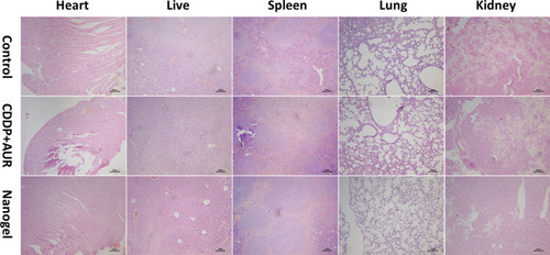 Figure 10 Histological analyses by H&E staining of heart, liver, spleen, lung, and kidney in BALB/C mice that were treated with 0.9% NaCl, CDDP+AUR, and the nanogel. Scale bar: 200 µm.