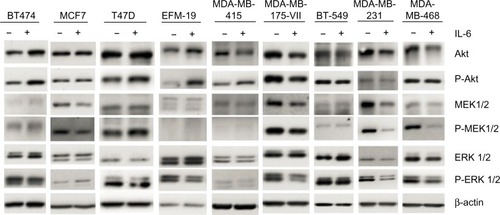 Figure 2 Effect of recombinant IL-6 on Akt, MEK 1/2, and ERK 1/2 phosphorylation in ERα-positive and ERα-negative cell lines.