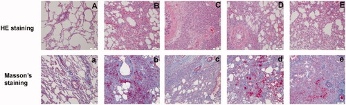 Figure 11. Images of lung tissue on day 28 stained with 28-d hematoxylin and eosin (HE) and Masson’s trichrome (×200) in the sham-operation group (A, a), model group (B, b), low-dose group (C, c), middle-dose group (D, d), and high-dose group (E, e).