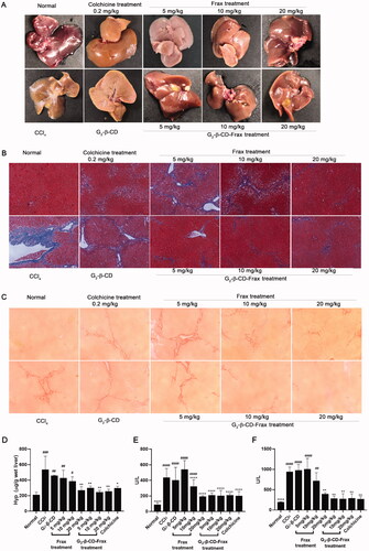 Figure 8. G2-β-CD-Frax improved anti-fibrosis efficacy of Frax on the CCl4-induced mouse model. Representative photos of liver tissues (A) and images of liver sections with Masson (B) and Sirius red staining (C). (Scale bars, 100 μm) (D) Concentration of liver HYP. (E) ALT and (F) AST levels in serum. ****p < .0001, **p < .01, *p < .05, compared with the CCl4-induced group. ####p < .0001, ###p < .001,##p < .01, #p < .05, compared with normal group. Data are mean ± SD (n = 3 per group).