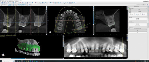 Figure 6. Model imported and automatic alignment.